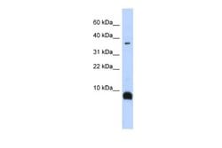 Neurokinin B Rabbit anti-Human, Polyclonal, Novus Biologicals 0.1 mL | Buy Online | Novus Biologicals | Fisher Scientific